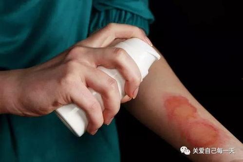 被烫伤敢吃凉瓜吗图片